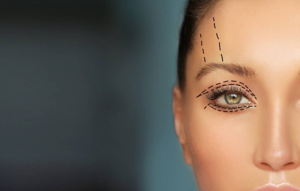 Different Types Of Eyelid Surgery Chicago Oculofacial Consultants Blog 